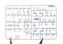 1:72 Avia S-199 ERLA canopy (WEEKEND edition)